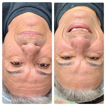 Vickkimua - Deep Cleansing facial w/ Extractions - Skin Care Near Me - Selma, Texas Vickkimua - Deep Cleansing facial w/ Extractions - Skin Care Near Me - Selma, Texas