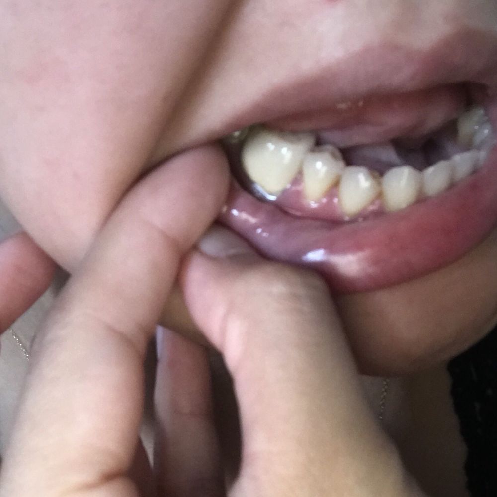 Jay M Marks, DMD - Now I know back molars are supposed to be bigger, but look at the size of that thing! It's horrific!! - General Dentistry Near Me - Danbury, Connecticut Jay M Marks, DMD - Now I know back molars are supposed to be bigger, but look at the size of that thing! It's horrific!! - General Dentistry Near Me - Danbury, Connecticut
