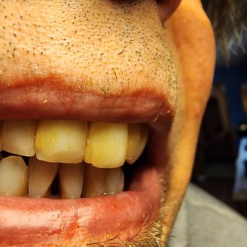 Cancún Dental Specialists - Oral Surgeons Near Me - Cancún, ROO Cancún Dental Specialists - Oral Surgeons Near Me - Cancún, ROO