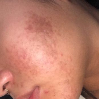 Lindy’s Skin Studio - Skin Care Near Me