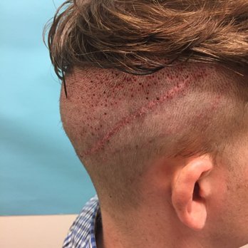 McGrath Medical - Hair Loss Centers Near Me - Austin, Texas McGrath Medical - Hair Loss Centers Near Me - Austin, Texas
