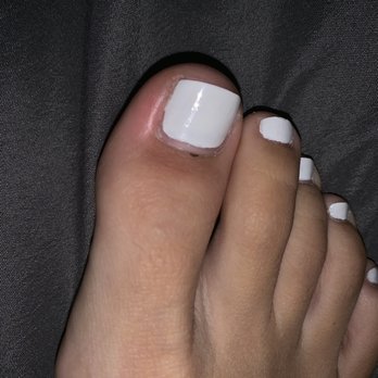 Winchester Nails - getting puss now and she cut my cuticle too much it started bleeding ! - Nail Salons Near Me - San Jose, California Winchester Nails - getting puss now and she cut my cuticle too much it started bleeding ! - Nail Salons Near Me - San Jose, California