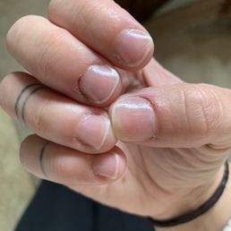 Middle finger and thumb bleeding from cuticle clipping. Sides of nails dry skin and not cleaned up.