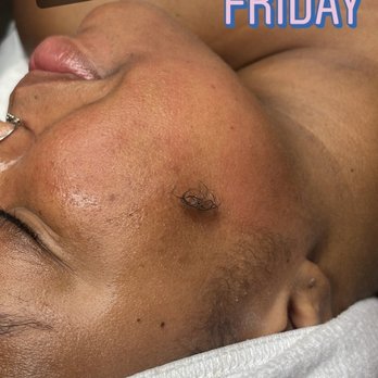 Lashed By Jazz - Glow up facial + dermaplaning - Eyelash Service Near Me
