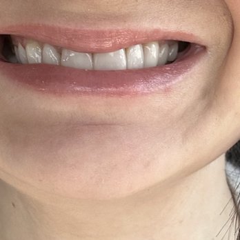 My Youth Aesthetics MedSpa - DO NOT come here for botox!! - Skin Care Near Me - Orange, California