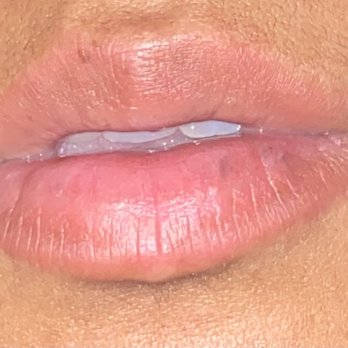Trophy Beauty - After initial treatment and follow-up treatment - Waxing Near Me - Elk Grove, California Trophy Beauty - After initial treatment and follow-up treatment - Waxing Near Me - Elk Grove, California