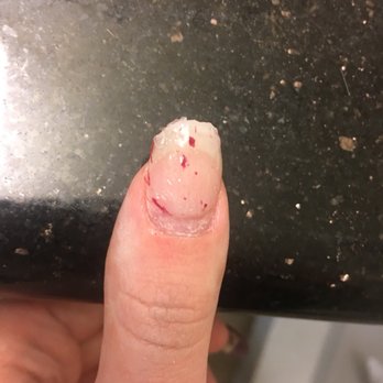 Nail Today - After soaking the acrylic is slimy and sticky- possible MMA. - Nail Salons Near Me - Oakland, California Nail Today - After soaking the acrylic is slimy and sticky- possible MMA. - Nail Salons Near Me - Oakland, California