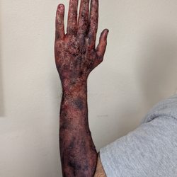 I Make Faces - Burnt bloody arm- effects makeup by Diana Tenes / I Make Faces