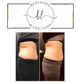 Redlands Blade & Lash - Cryoskin slimming loose 12-1 inch in 30 minute with fat freezing - Permanent Makeup Near Me - Redlands, California Redlands Blade & Lash - Cryoskin slimming loose 12-1 inch in 30 minute with fat freezing - Permanent Makeup Near Me - Redlands, California