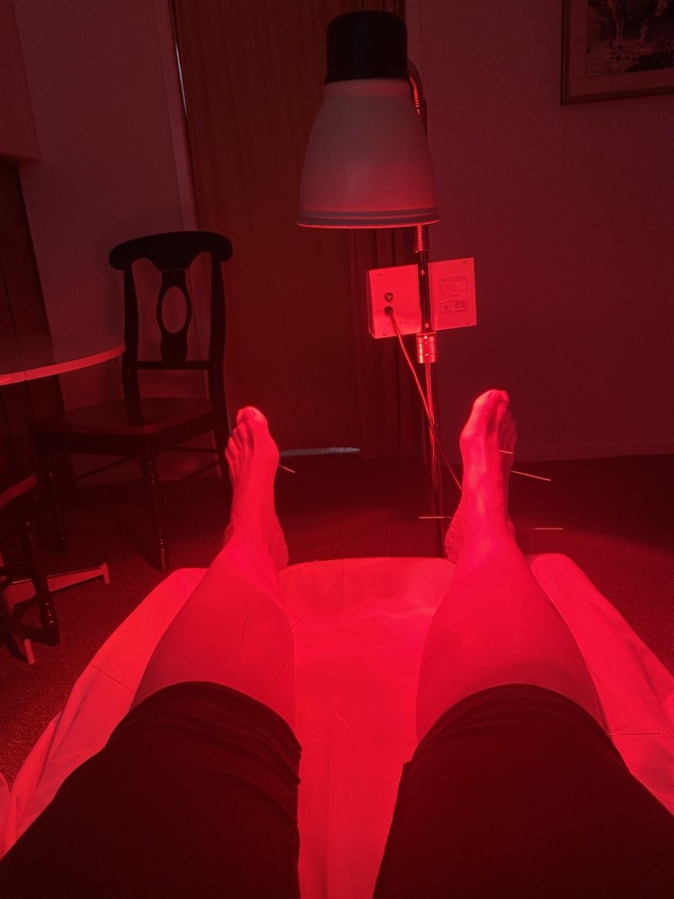 PROACTIVE ACUPUNCTURE 17 Photos & 52 Reviews Nutritionists 2401