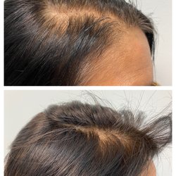 Cellustrious Hair Rejuvenation
