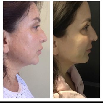 Bellissima Medical Spa - Medical Spas Near Me - Long Beach, California