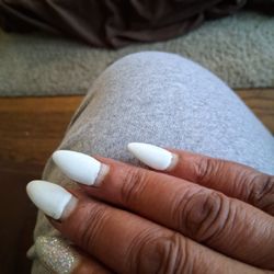 Bliss Nails - Other hand after 1 week with fungus