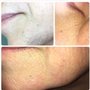 Photo of Everlasting Hair Removal By Kim