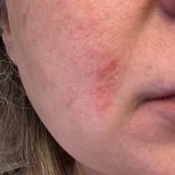 Brow Arc - Bellevue Square