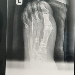 Integrative Foot & Ankle Centers of Washington