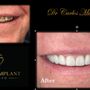 Photo of Dental Implant Studio - Miami Lakes