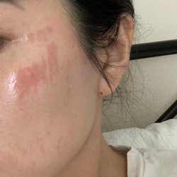 Waxology LA - This happened and she asked me if I wanted to continue on the other side of my face.