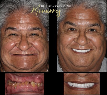 Alfonso Monarres, DDS, MS, FACP