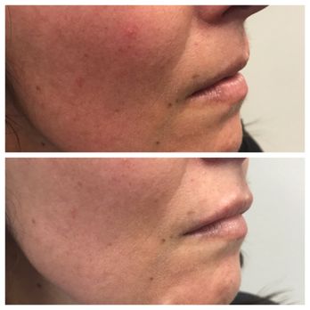 Beyond Beauty Aesthetics - Medical Spas Near Me - Sacramento, California Beyond Beauty Aesthetics - Medical Spas Near Me - Sacramento, California