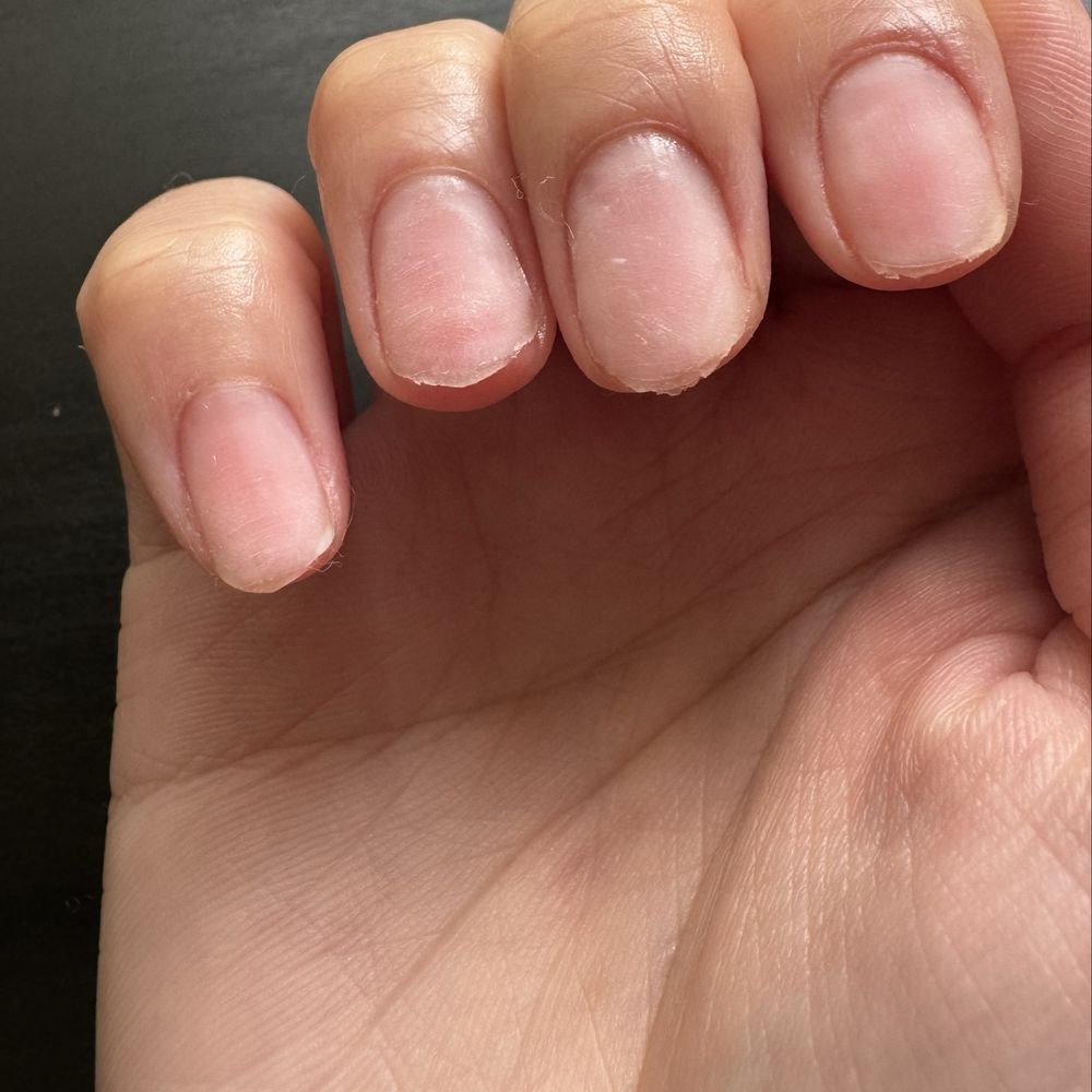 3rd and 4th finger 3rd and 4th finger