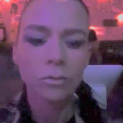 Let's Face It Botox And More - Slightly blurry from club lights after Botox and filler in my cheeks and jawline