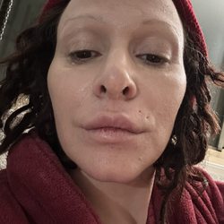 Century Dermatology 清清皮肤诊所 - My lip is hard as a rock