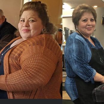 West Medical - Antes de mi cirugía y después - Weight Loss Centers Near Me - Tarzana, California West Medical - Antes de mi cirugía y después - Weight Loss Centers Near Me - Tarzana, California