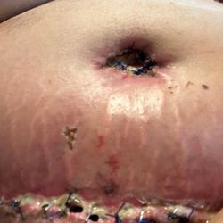 Kirit Bhatt, MD, FACS: Rejuve Plastic Surgery