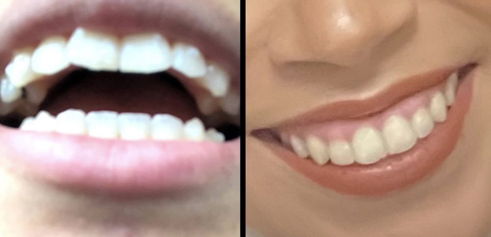 Dream Smiles Dental Arts