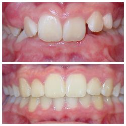 E. MacKay Tingey, DDS, MS
