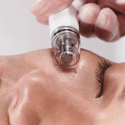 Elite Body & Laser Center - Diamond Glow