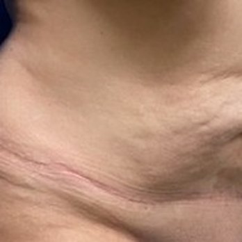 Los Angeles Liposuction Centers - Cosmetic Surgeons Near Me - Beverly Hills, California Los Angeles Liposuction Centers - Cosmetic Surgeons Near Me - Beverly Hills, California