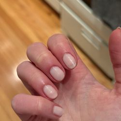 Swollen cuticles