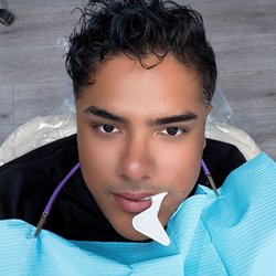California Dental Group - Me at the dentist.