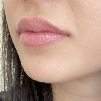 Gig Harbor Aesthetics - Skin Care Near Me - Gig Harbor, Washington