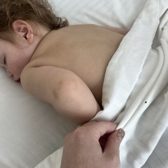 Pacifica Beach Hotel - Bed bugs on my two year old. - Hotels Near Me - Pacifica, California