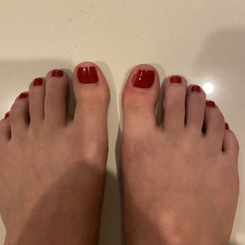 XOXO Nail Bar - Right foot, big toe infection. Postpedicure 4 days. (Thursday pedi, Saturday pic) - Nail Salons Near Me - Irvine, California XOXO Nail Bar - Right foot, big toe infection. Postpedicure 4 days. (Thursday pedi, Saturday pic) - Nail Salons Near Me - Irvine, California