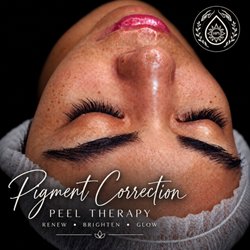 Holistic Perfect Skin