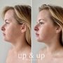 up & up