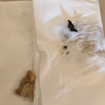 Capital Seafood - A piece of sharp plastic inside of their food - Dim Sum Near Me - Arcadia, California