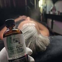 Up Close Skin Care - Great for Hyperpigmentation and Anti-Aging