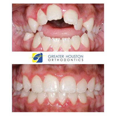 Greater Houston Orthodontics