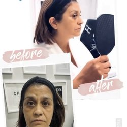 Shape Your Body By Mary - New Face. Whose this? Non surgical face lift.