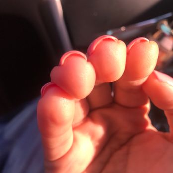 Kathy's Nails - Acrylic Powder not removed completely yet still charged for it - Nail Salons Near Me - Santa Ana, California Kathy's Nails - Acrylic Powder not removed completely yet still charged for it - Nail Salons Near Me - Santa Ana, California