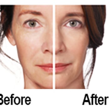 Z Med Clinic - Weight Loss Centers Near Me - Spring, Texas
