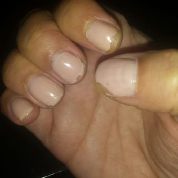 Paris Salon & Day Spa - Pictures of the mani/pedi 24 hours later. - Day Spas Near Me - Tampa, Florida Paris Salon & Day Spa - Pictures of the mani/pedi 24 hours later. - Day Spas Near Me - Tampa, Florida