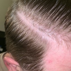 Miracles In Motion - Horrible hair cut