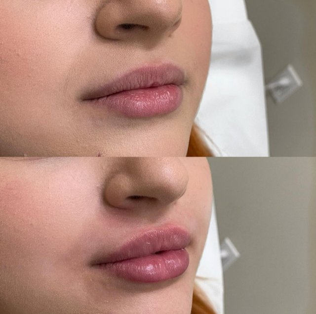 Elevate Aesthetics Logo