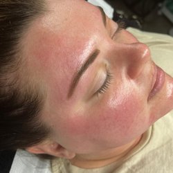 Joia Skin - Post Lactic Acid brightening facial